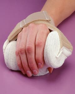 Rolyan Carve-It Hand Positioning Orthosis