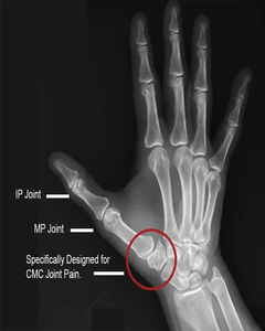 Comfort Cool Thumb CMC Restriction Splint