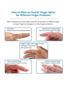 3pp® Oval-8® Finger Splint Kit