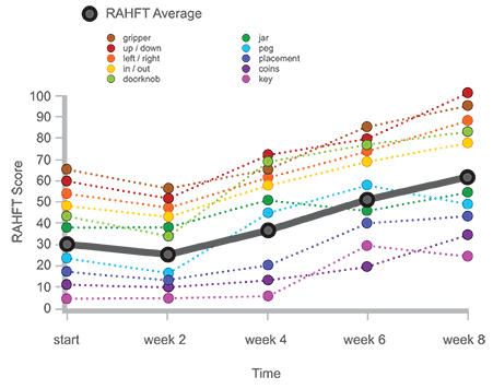 ReJoyce Rehabilitation Workstation